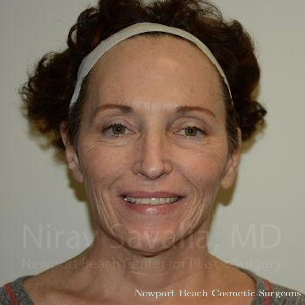 Mommy Makeover Before & After Gallery - Patient 1655712 - Before
